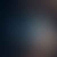 Busting the Myths: The Truth About the Refresh Rate of the Human Eye